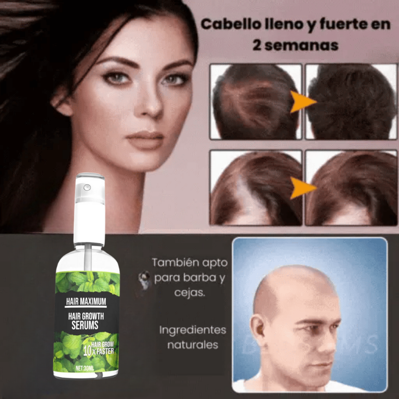 Solución Natural Para El Cabello - Crecimiento 4 veces más rápido